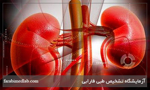 پیوند کلیه