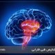 کاهش خطر سکته مغزی