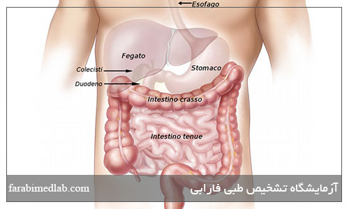 بیماری فلج معده