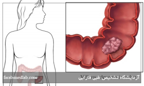 آزمایش خون در مدفوع