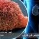 مراحل سرطان مثانه