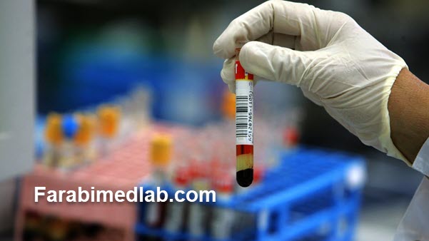 تحویل جواب در منزل | آزمایشگاه فارابی