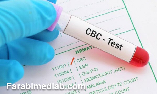 آزمایش CBC چگونه انجام می شود؟ - آزمایشگاه فارابی