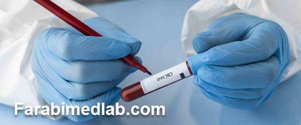 آزمایش CBC چگونه انجام می شود؟ آزمایشگاه فارابی