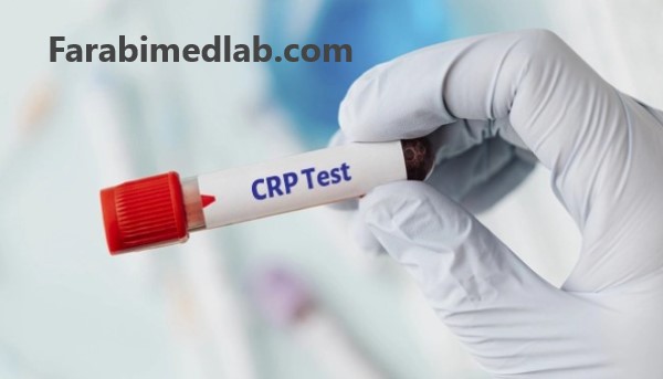 Crp در آزمایش خون باید چند باشد آزمایشگاه فارابی