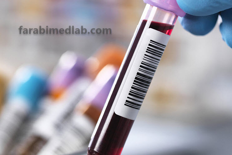 انجام تست EPO در آزمایشگاه فارابی | آزمایشگاه فارابی