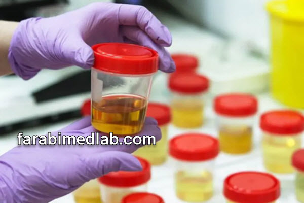 انواع سلولهای اپیتلیال کدام است؟ | آزمایشگاه فارابی