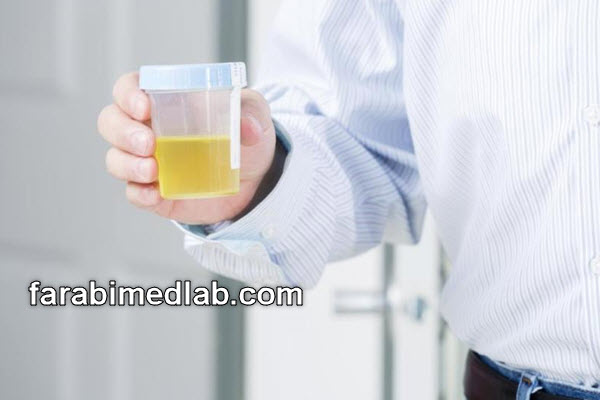 مقدار نرمال epithelial cells در آزمایش ادرار | آزمایشگاه فارابی
