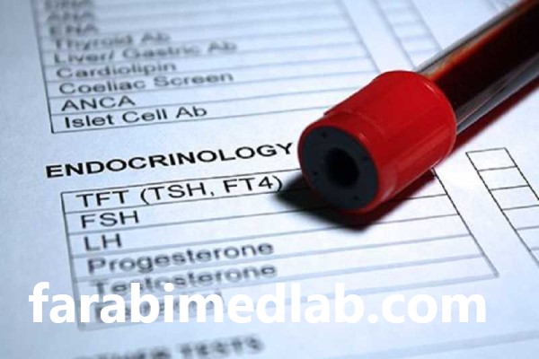 لیست کامل آزمایش های هورمونی | آزمایشگاه فارابی