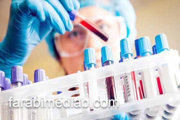 مرکز تخصصی تست CA242 | آزمایشگاه فارابی