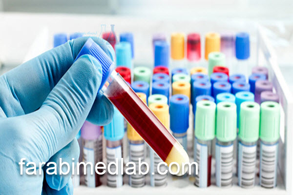 انجام تست CA242 در آزمایشگاه تخصصی | آزمایشگاه فارابی