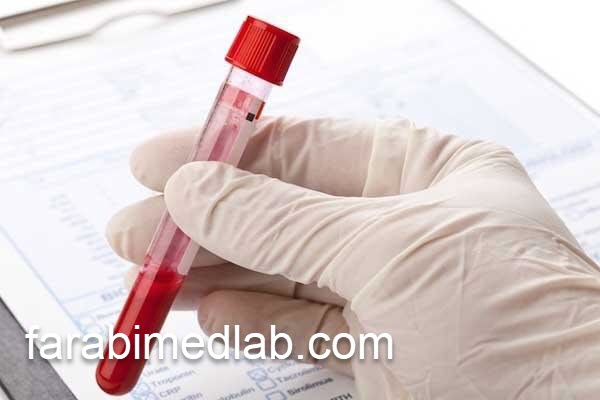 انجام آزمایش SGPT در مرکز تخصصی معتبر | آزمایشگاه فارابی