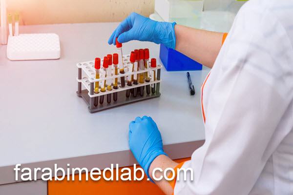 تفسیر نتایج آزمایش استیل کولین | آزمایشگاه فارابی