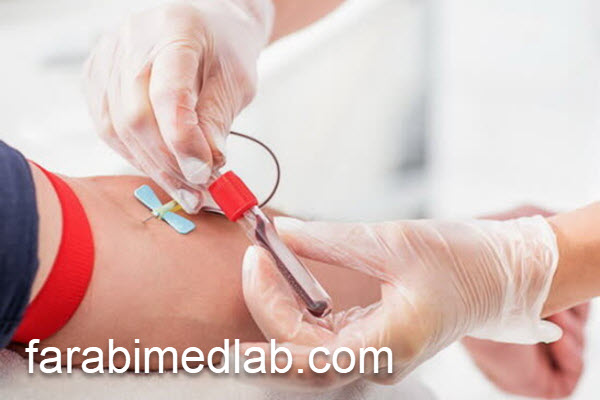 آزمایش استیل کولین در آزمایشگاه تخصصی | آزمایشگاه فارابی
