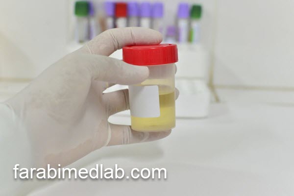 انجام آزمایش متانفرین در شمال تهران | آزمایشگاه فارابی