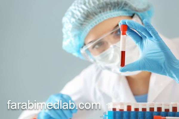 آزمایش گاسترین با هزینه مناسب | آزمایشگاه فارابی