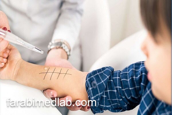 تست آلرژی با قیمت مناسب | آزمایشگاه فارابی