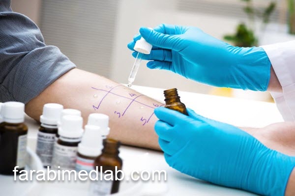 قیمت تست آلرژی در سال 1404 | آزمایشگاه فارابی