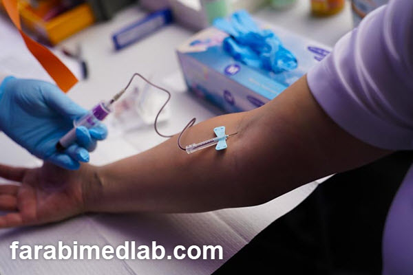 انجام تست renin در آزمایشگاه فارابی