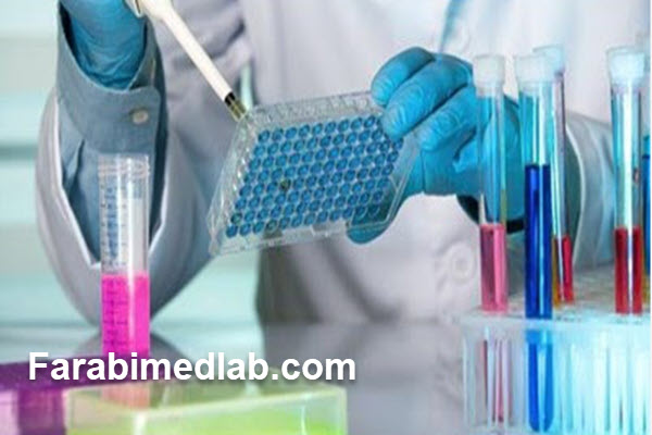 شرایط انجام آزمایش سروتونین