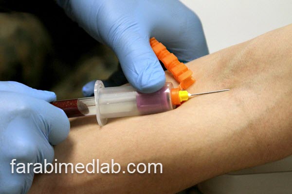 آزمایشگاه معتبر برای انجام تست توکسوکارا | آزمایشگاه فارابی