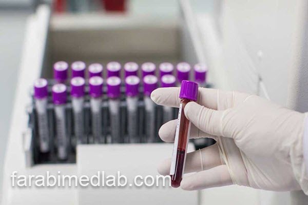 بهترین آزمایشگاه برای انجام تست فاسیولا | آزمایشگاه فارابی
