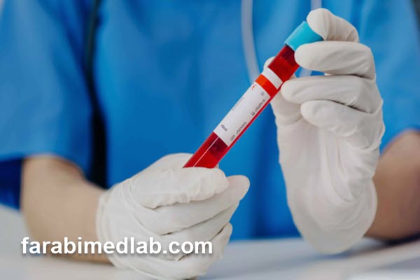 تفاوت کلسترول خوب و بد چیست؟