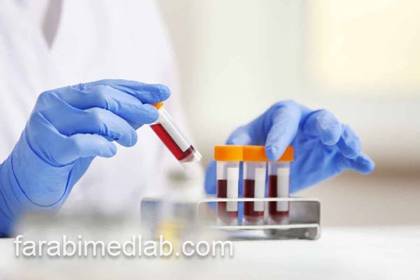 تست خون کامل در آزمایشگاه معتبر | آزمایشگاه فارابی