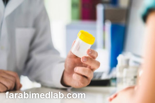 انواع آزمایش های تشخیصی برای عفونت ادراری