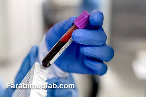چربی خون چیست و چه نقشی در بدن دارد؟