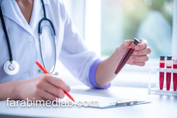 بررسی آزمایش خون کامل | آزمایشگاه فارابی