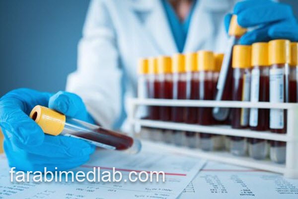 انجام آزمایش فاسیولا در آزمایشگاه معتبر | آزمایشگاه فارابی