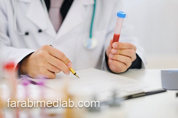 انجام آزمایش توکسوکارا در آزمایشگاه تخصصی | آزمایشگاه فارابی