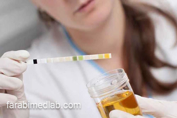 معنای Semi clear در آزمایش ادرار | آزمایشگاه فارابی