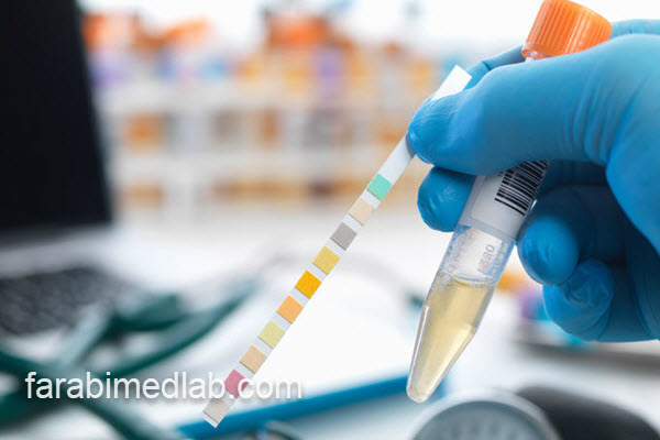 Semi clear در تست ادرار | آزمایشگاه فارابی