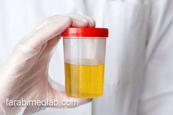 بررسی Semi clear در آزمایش ادرار | آزمایشگاه فارابی