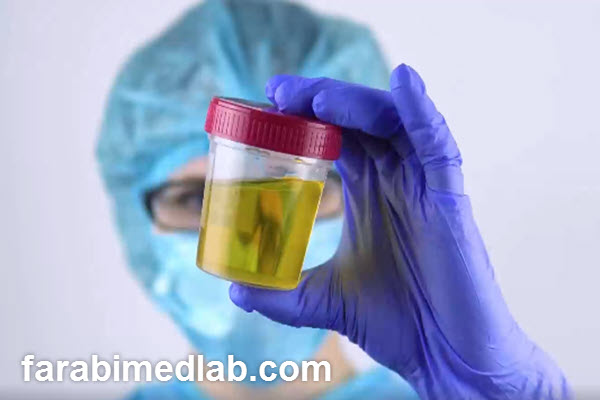 تفسیر آزمایش عفونت ادراری