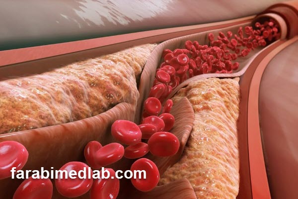 آزمایش چربی خون نرمال چند است؟