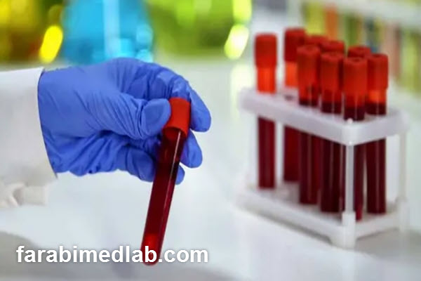 اهمیت زمان در آزمایش های ژنتیک و نحوه مدیریت آن