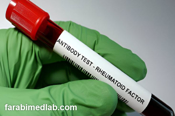 performing-a-rheumatism-blood-test-at-farabi-laboratory-farabimedlab.com انجام آزمایش خون روماتیسم در آزمایشگاه فارابی