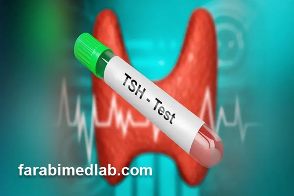 نقش والدین در پیگیری نتایج آزمایش