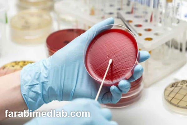 نکات مهم قبل از انجام آزمایش ادرار بارداری