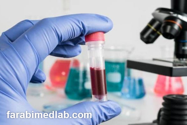بهترین آزمایشگاه برای آزمایش DNA در تهران