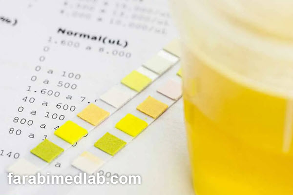 why-is-a-pregnancy-urine-test-performed-farabimedlab.com آزمایش ادرار بارداری به چه دلیل انجام می شود؟