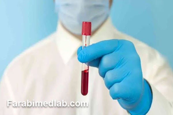 مزایای انجام آزمایش تیروئید در آزمایشگاه فارابی