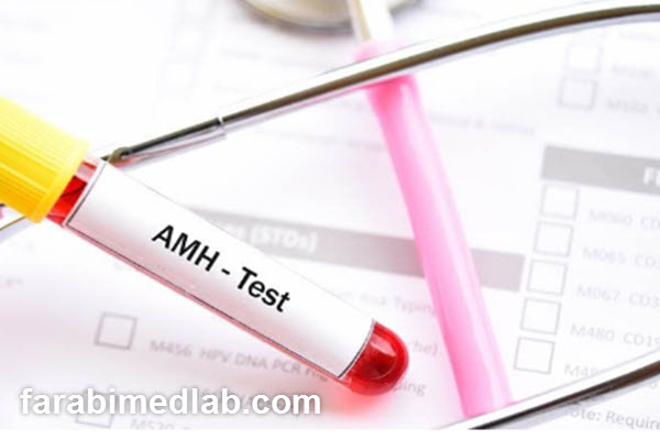 محدوده نرمال AMH در سنین مختلف