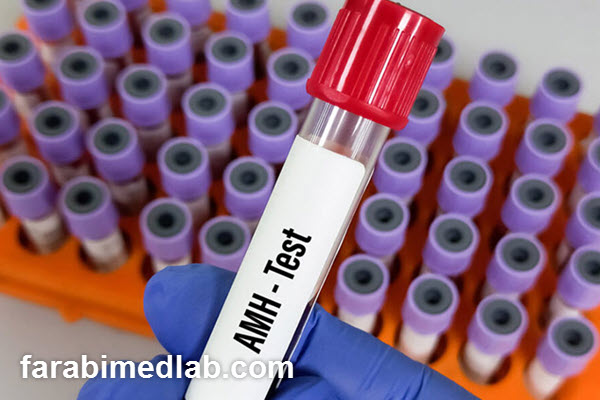 نقش آزمایشگاه فارابی در ارزیابی AMH