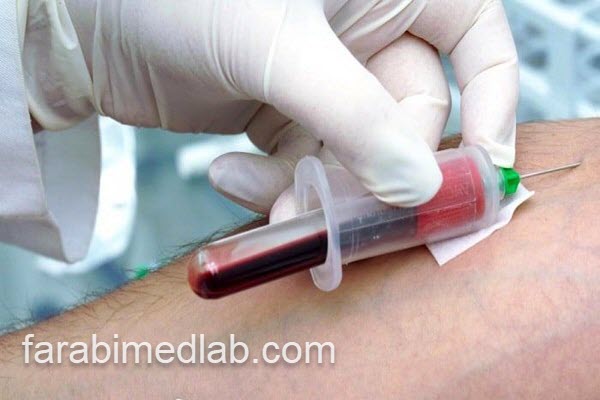 خدمات آزمایش در منزل | آزمایشگاه فارابی
