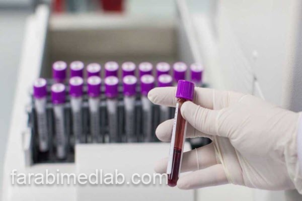 آزمایش pct با قیمت مناسب | آزمایشگاه فارابی
