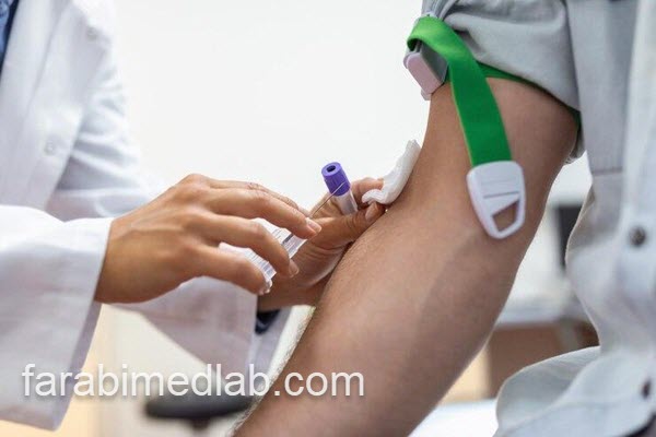 هزینه و قیمت آزمایش pct | آزمایشگاه فارابی